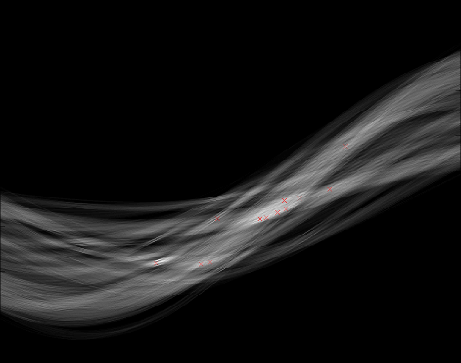 dominant straight lines